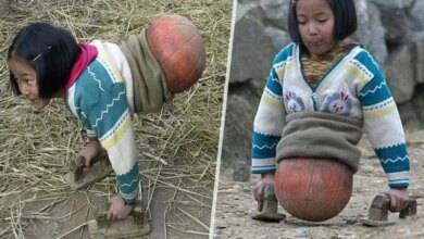 Se você acha que sua vida é ruim, veja esta história inspiradora sobre a garota “Basquete”