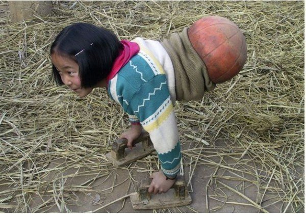 1499962210 672 se voce acha que sua vida e miseravel veja esta historia inspiradora sobre a garota basquete