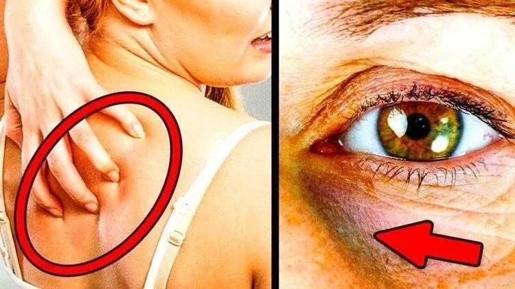 Sinais de alerta de que está comendo muito açúcar