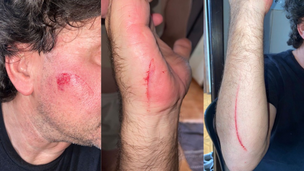 Vítima teve ferimentos superificiais pelo corpo — Foto: Arquivo pessoal